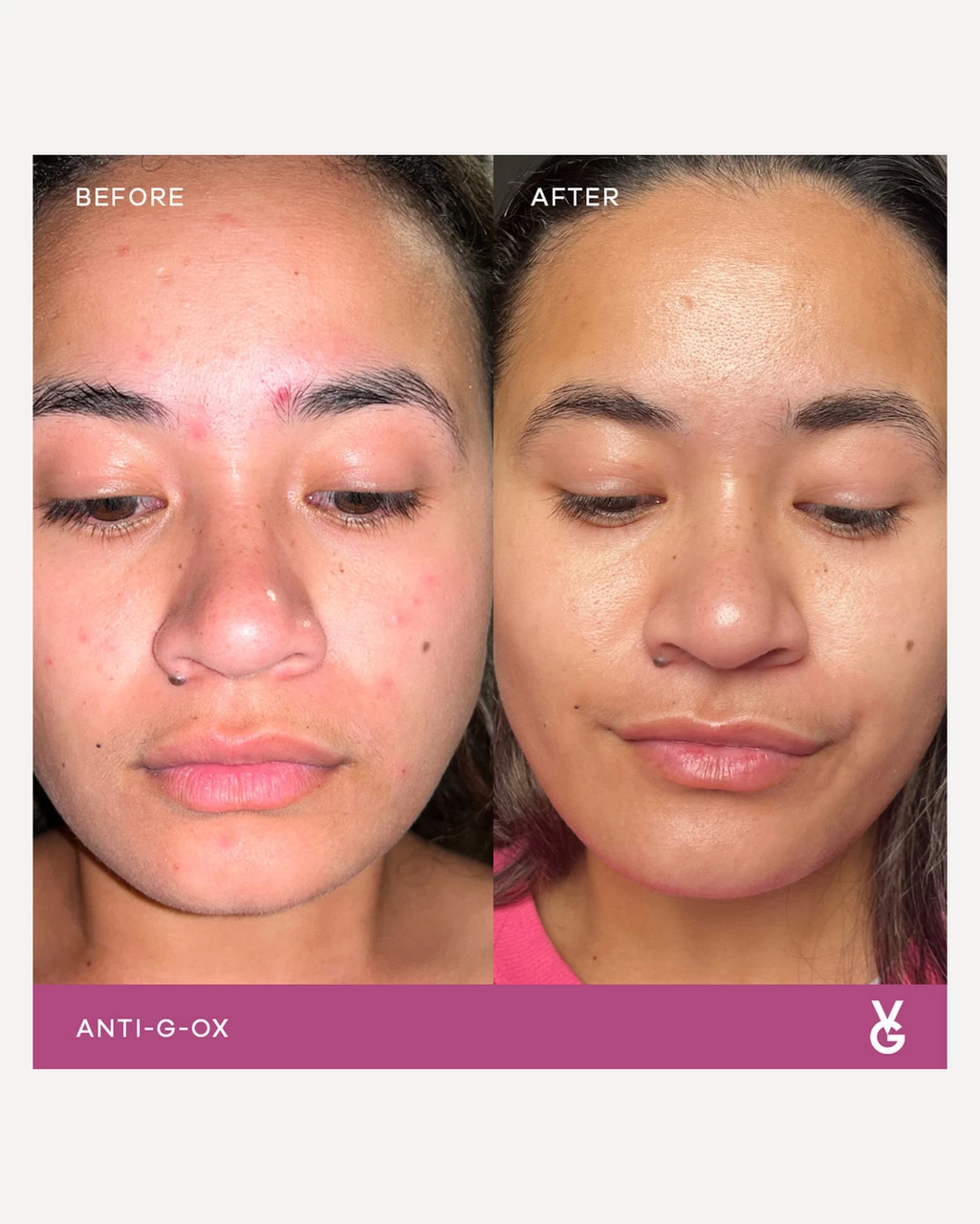 Vida Glow Anti-G-Ox Starter Pack - Image 4